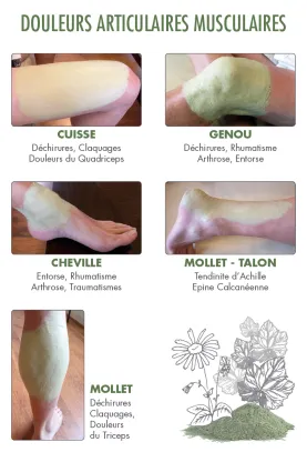 3+1 ANGEBOT - Cryo Tonerde Breiumschlag zur Linderung von Muskeln und Gelenken - AGYflex® GRÜNER ARGILLE