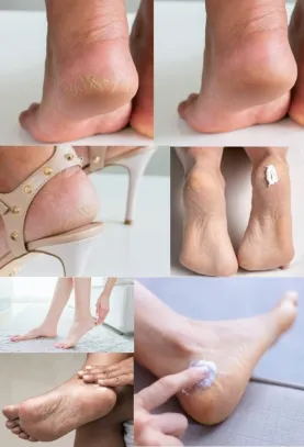 ARGESIL MASSAGE-CREME mit weißer Tonerde, feuchtigkeitsspendend, pflegend und beruhigend für trockene Füße - Claude Bell